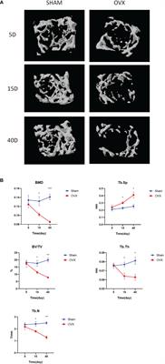 Early changes of bone metabolites and lymphocyte subsets may participate in osteoporosis onset: a preliminary study of a postmenopausal osteoporosis mouse model